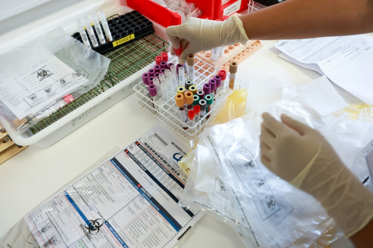 Des tests de dépistage du chikungunya sont faits au laboratoire du centre hospitalier universitaire de Saint-Denis, sur l'île de La Réunion, le 10 avril 2025