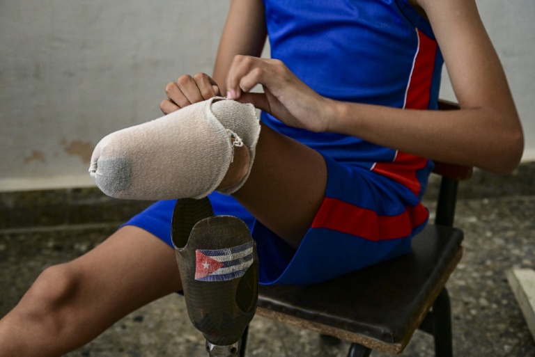 Juan Jose Guilarte protège son moignon avant de mettre sa prothèse pour une session d'entraînement de pentathlon à La Havane, le 16 avril 2026 à Cuba