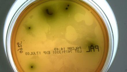 Gros plan d'une souche de listeria pris le 10 mai 2000 au laboratoire d'analyse départementale de la Manche à St Lo