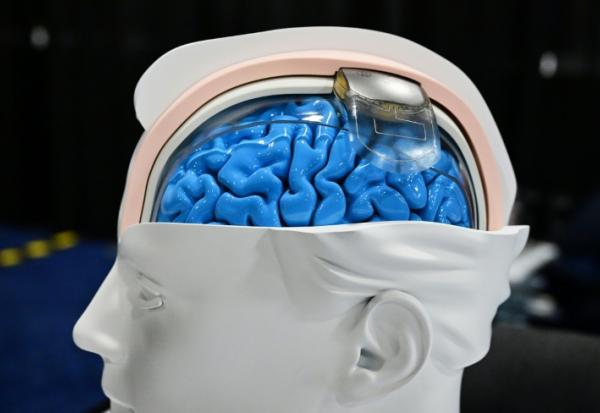 Un implant Wimagine de CEA pour aider les patients atteints de lésions de la moelle épinière à remarcher, est présenté au Consumer Electronics Show (CES), le 7 janvier 2024 à Las Vegas, dans le Nevada