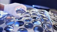 EssilorLuxottica acquiert RetinAI