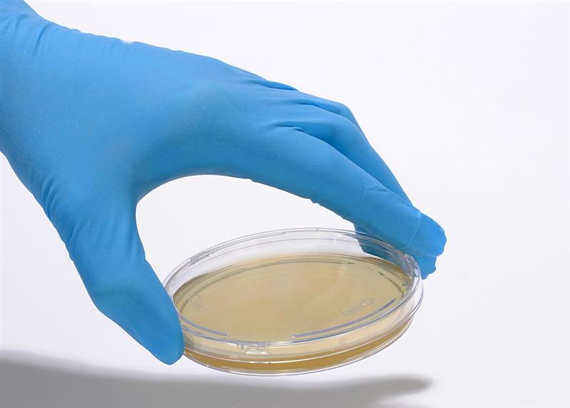 Biomérieux lance Spinchip, une plateforme de biologie délocalisée à résultat rapide